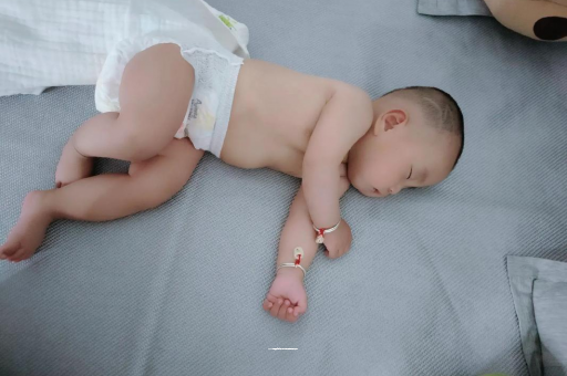 武汉六个月宝宝眼睛散光